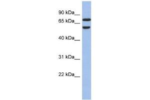 GNL3L antibody used at 1 ug/ml to detect target protein. (GNL3L anticorps)