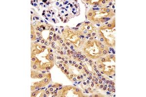 (ABIN6243754 and ABIN6578197) staining ML2 in hun kidney tissue sections by Immunohistochemistry (IHC-P - paraforldehyde-fixed, paraffin-embedded sections). (MAML2 anticorps  (AA 780-814))