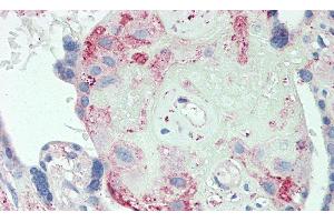 Detection of ORM2 in Human Placenta Tissue using Polyclonal Antibody to Orosomucoid 2 (ORM2) (Orosomucoid 2 anticorps  (AA 19-207))