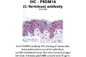 Image no. 1 for anti-PR Domain Containing 16 (PRDM16) (C-Term) antibody (ABIN1738317) (PRDM16 anticorps  (C-Term))