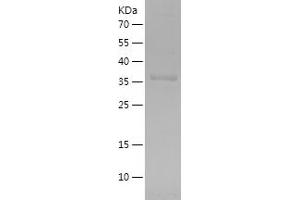 Western Blotting (WB) image for Fibrinogen-Like 2 (FGL2) (AA 26-178) protein (His-IF2DI Tag) (ABIN7122912) (FGL2 Protein (AA 26-178) (His-IF2DI Tag))