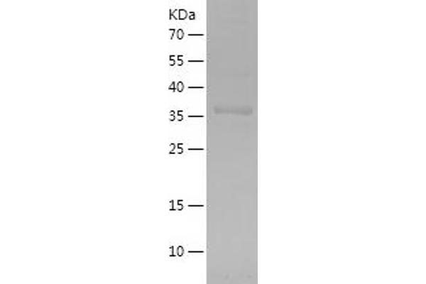 FGL2 Protein (AA 26-178) (His-IF2DI Tag)