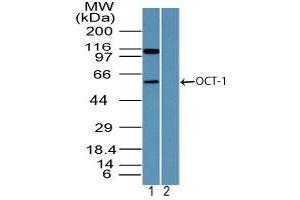 Image no. 2 for anti-POU Domain, Class 2, Transcription Factor 1 (POU2F1) (AA 1-50) antibody (ABIN960311) (POU2F1 anticorps  (AA 1-50))