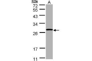 WB Image Sample (30 ug of whole cell lysate) A: Hep G2 , 10% SDS PAGE antibody diluted at 1:1000 (GSTT1 anticorps)