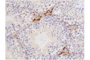 ABIN6267358 at 1/200 staining Mouse testis tissue sections by IHC-P.
