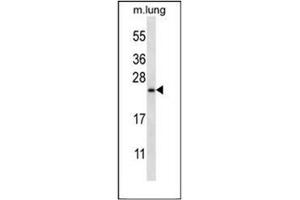 Western blot analysis of RHEBL1 (N-term) in Mouse lung tissue lysates (35ug/lane). (RHEBL1 anticorps  (N-Term))