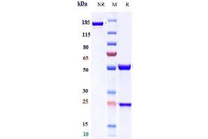 Anti-ICOS / CD278 Reference Antibody (feladilimab) on SDS-PAGE under reducing (R) condition.