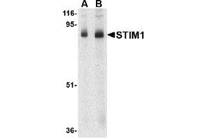 Western Blotting (WB) image for anti-Stromal Interaction Molecule 1 (STIM1) (C-Term) antibody (ABIN1030706) (STIM1 anticorps  (C-Term))
