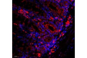 Immunofluorescence of paraffin embedded mouse rectum using WDR81 (ABIN7076221) at dilution of 1: 700 (400x lens)