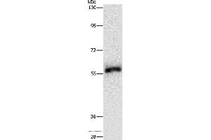 Western blot analysis of Hela cell, using HCK Polyclonal Antibody at dilution of 1:500 (HCK anticorps)