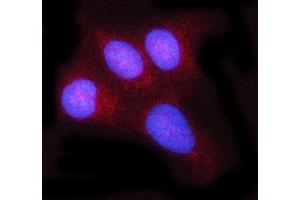 IF analysis of c-Rel/REL using anti-c-Rel/REL antibody (ABIN7599778). (c-Rel anticorps  (AA 116-610))