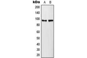 Western blot analysis of PLA2G4A (pS505) expression in HeLa lambda protein phosphatase-treated (A), NIH3T3 lambda protein phosphatase-treated (B) whole cell lysates. (PLA2G4A anticorps  (pSer505))