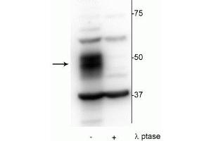 Western blot of OCIAML2 lysate showing specific immunolabeling of the ~51 kDa MEF2C phosphorylated at Ser222 in the first lane (-).