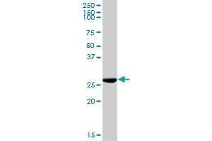 KHK MaxPab rabbit polyclonal antibody. (Ketohexokinase anticorps  (AA 1-298))