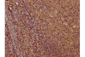 IHC image of ABIN7147133 diluted at 1:100 and staining in paraffin-embedded human tonsil tissue performed on a Leica BondTM system.