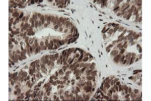 Image no. 4 for anti-Zinc Finger and SCAN Domain Containing 18 (ZSCAN18) antibody (ABIN1501858) (ZSCAN18 anticorps)