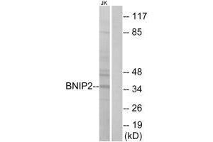 Western blot analysis of extracts from Jurkat cells, using BNIP2 antibody. (BNIP2 anticorps  (C-Term))