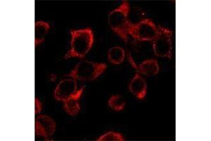 Immunofluorescence (IF) image for anti-Interleukin 23 (IL23) antibody (ABIN2665147) (IL23 anticorps)