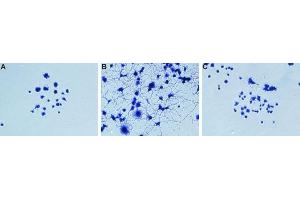 NGF-induced neurite outgrowth neutralizing assayPC12 cells were grown on collagen-coated plates.