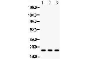 Western Blotting (WB) image for anti-Syndecan 4 (SDC4) (AA 172-198), (C-Term) antibody (ABIN3043323) (SDC4 anticorps  (C-Term))