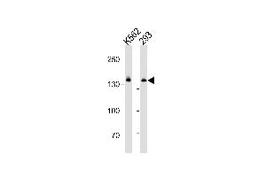 DHX9 Antibody (N-term) (ABIN1881260 and ABIN2843377) western blot analysis in K562 and 293 cell line lysates (35 μg/lane). (DHX9 anticorps  (N-Term))