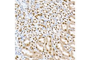 Immunohistochemistry of paraffin-embedded mouse kidney using RBM3 Rabbit mAb (ABIN7270084) at dilution of 1:25 (40x lens). (RBM3 anticorps)