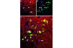 Expression of B2 bradykinin receptor in mouse spinal cord - Immunohistochemical staining of mouse spinal cord using Anti-B2 Bradykinin Receptor (BDKRB2) Antibody (ABIN7042968, ABIN7043942 and ABIN7043943).