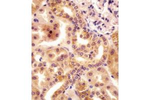 (ABIN655484 and ABIN2845005) staining RSBN1 in human kidney tissue sections by Immunohistochemistry (IHC-P - paraformaldehyde-fixed, paraffin-embedded sections). (RSBN1 anticorps  (N-Term))