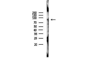 Western blot analysis of lysates from Mouse liver, using NOX5 Antibody at 1/1000 dilution.
