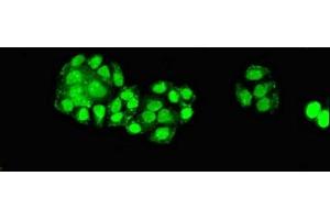 anti-Elongator Acetyltransferase Complex Subunit 6 (ELP6) (AA 95-195) antibody