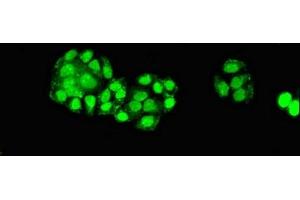 Immunofluorescent analysis of PC-3 cells using ABIN7151588 at dilution of 1:100 and Alexa Fluor 488-congugated AffiniPure Goat Anti-Rabbit IgG(H+L) (ELP6 anticorps  (AA 95-195))