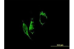 Immunofluorescence of purified MaxPab antibody to PYCR1 on HeLa cell. (PYCR1 anticorps  (AA 1-319))