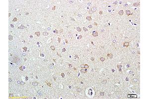 Formalin-fixed and paraffin embedded rat brain labeled with Rabbit Anti Phospho-HER3 (Tyr1289) Polyclonal Antibody, Unconjugated (ABIN747113) at 1:200 followed by conjugation to the secondary antibody and DAB staining