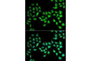 Immunofluorescence analysis of U2OS cell using UCN2 antibody. (Urocortin 2 anticorps)