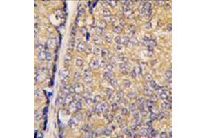 Image no. 1 for anti-Signal Transducing Adaptor Family Member 1 (STAP1) (N-Term) antibody (ABIN356991)