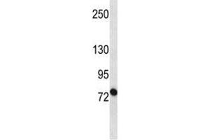 ABCB10 antibody western blot analysis in MCF-7 lysate Predicted molecular weight ~ 79 kDa.