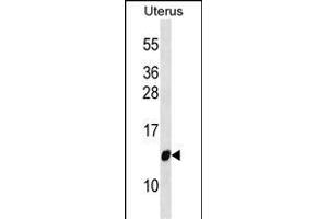 TI Antibody (Center) (ABIN6244225 and ABIN6577376) western blot analysis in Uterus tissue lysates (35 μg/lane). (TIMM10 anticorps  (AA 21-49))