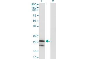 Western Blot analysis of IL1RN expression in transfected 293T cell line by IL1RN monoclonal antibody (M03), clone 1H5. (IL1RN anticorps  (AA 1-159))
