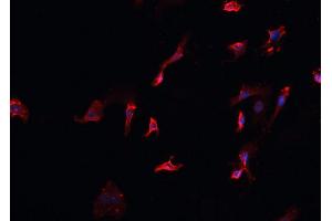 ABIN6266700 staining HeLa cells by IF/ICC. (MID1 anticorps  (N-Term))