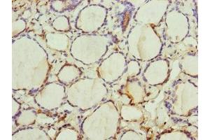 Immunohistochemistry of paraffin-embedded human thyroid tissue using ABIN7151252 at dilution of 1:100 (TRIM23 anticorps  (AA 1-280))