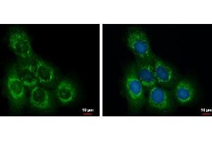 ICC/IF Image OCRL antibody detects OCRL protein at cytoplasm by immunofluorescent analysis. (OCRL anticorps  (C-Term))