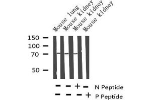 Western blot analysis of Phospho-Shc (Tyr349) expression in various lysates