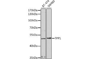 Western blot analysis of extracts of various cell lines, using TPP1 antibody (ABIN6127693, ABIN6149442, ABIN6149443 and ABIN6221263) at 1:1000 dilution.