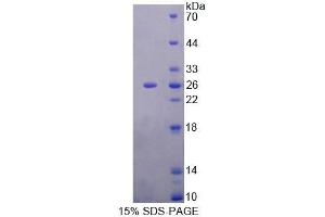 SDS-PAGE analysis of Rat MTUS1 Protein. (MTUS1 Protéine)