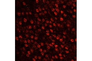Immunofluorescence (IF) image for anti-Squamous Cell Carcinoma Antigen Recognized By T Cells 3 (SART3) (AA 600-650) antibody (ABIN7449020)