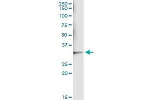 Immunoprecipitation of SULT1A1 transfected lysate using anti-SULT1A1 monoclonal antibody and Protein A Magnetic Bead , and immunoblotted with SULT1A1 monoclonal antibody.
