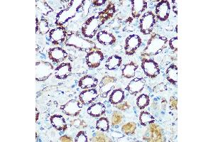 Immunohistochemistry of paraffin-embedded rat kidney using COX5B Rabbit pAb (ABIN3016355, ABIN3016356, ABIN3016357 and ABIN6219733) at dilution of 1:100 (40x lens).