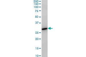 PAFAH1B3 monoclonal antibody (M02), clone 8C11.