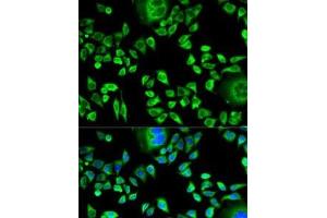 Immunofluorescence analysis of HeLa cells using CSTA Polyclonal Antibody (CSTA anticorps)