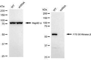 Western blotting analysis using P70 S6 Kinase beta antibody (ABIN7800226).